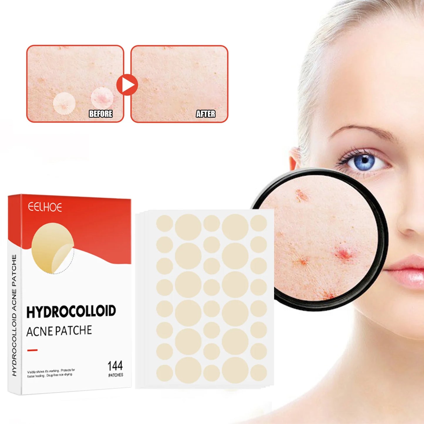 144pcs/set Face Skin Care Acne Pimple Patch